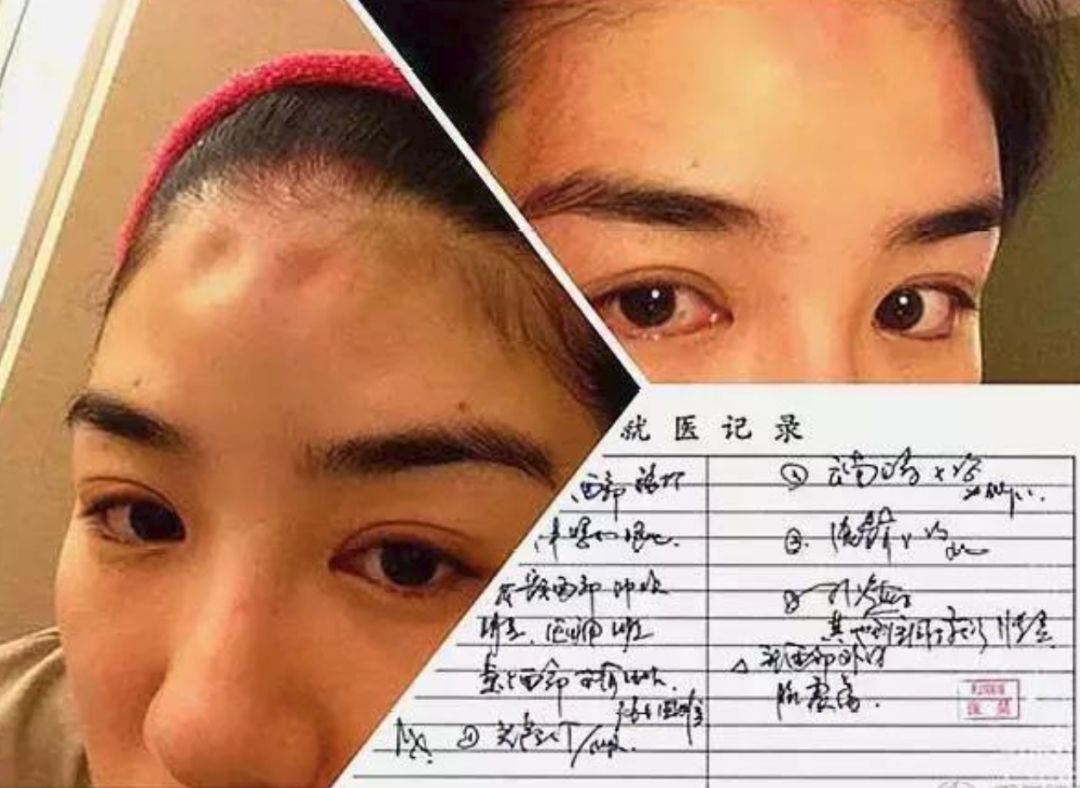 黃毅清吸毒被捕：黃奕，你為何會遇見這樣的渣男？