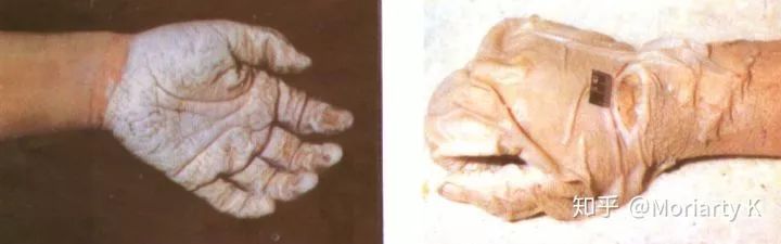 犯罪心理學(xué)：水塘中的碎腐之尸，是受害者亦是施暴者