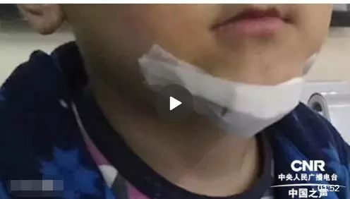孩子去世五天后，辦公室小野道歉了