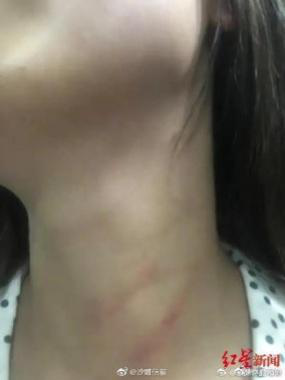 女教師遭家暴跳樓身亡：被逼到什么地步，才會以死解脫？