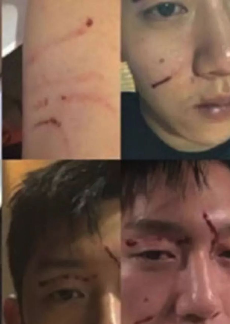 美麗，富有，年少成名，她為何選擇死亡？