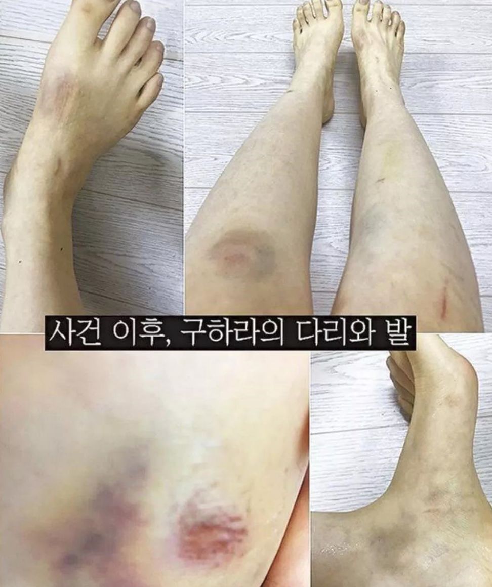 美麗，富有，年少成名，她為何選擇死亡？