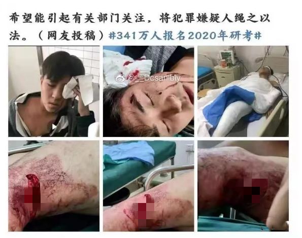 沈陽研究生砍人事件：這三件事，一定要讓孩子知道
