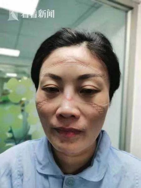 確診老人隱瞞致百余人密切接觸：比病毒更可怕的，是人心