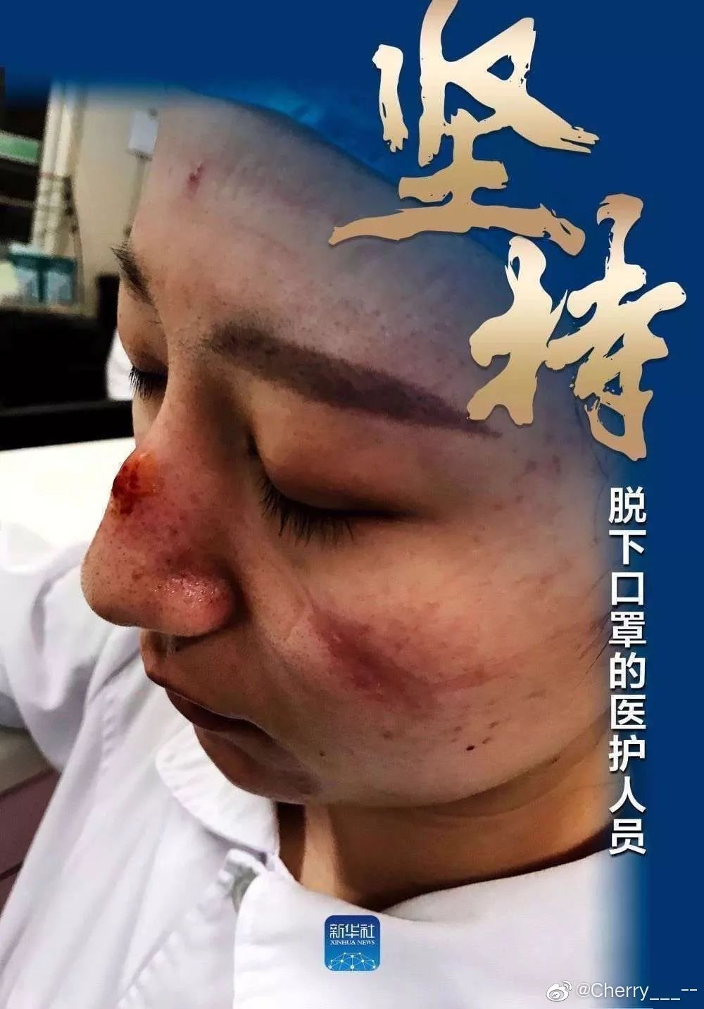 確診老人隱瞞致百余人密切接觸：比病毒更可怕的，是人心