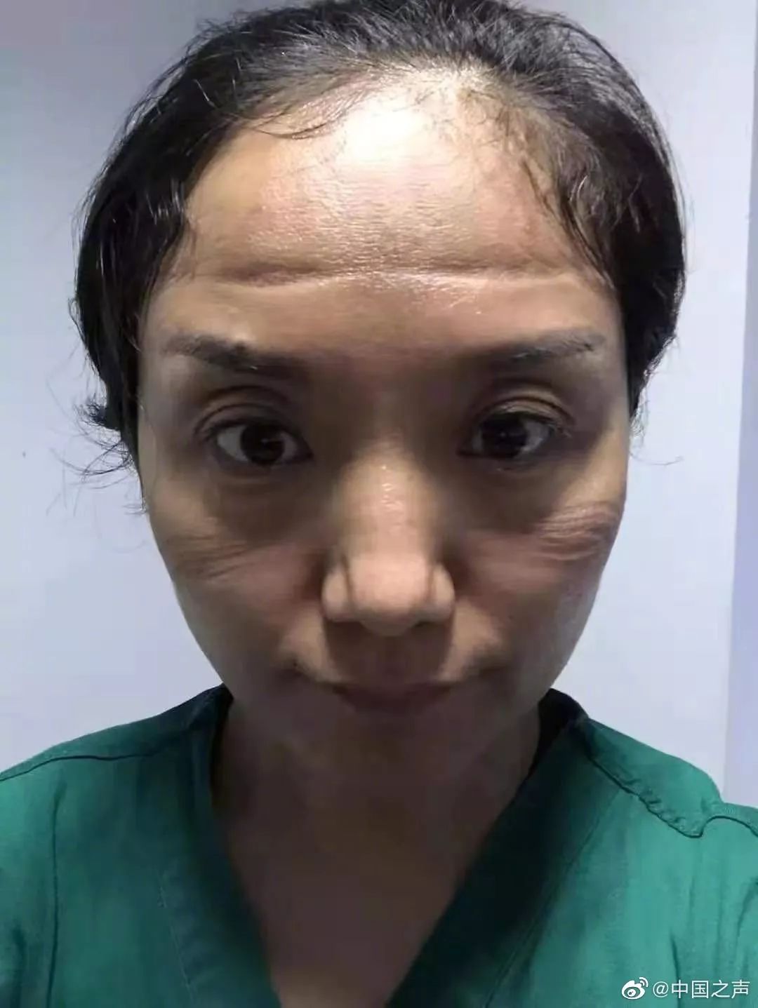 確診老人隱瞞致百余人密切接觸：比病毒更可怕的，是人心