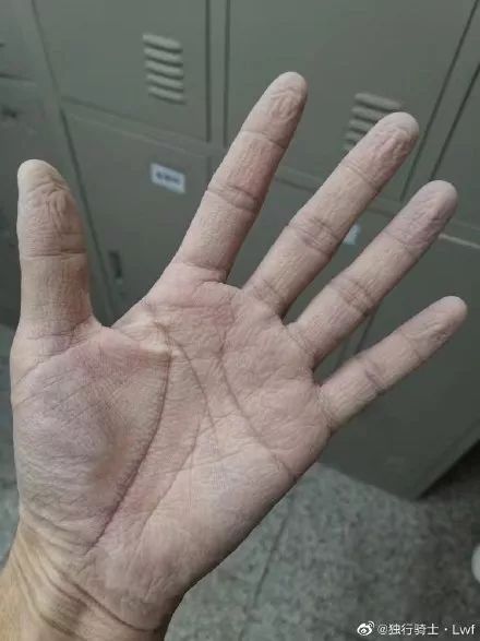確診老人隱瞞致百余人密切接觸：比病毒更可怕的，是人心