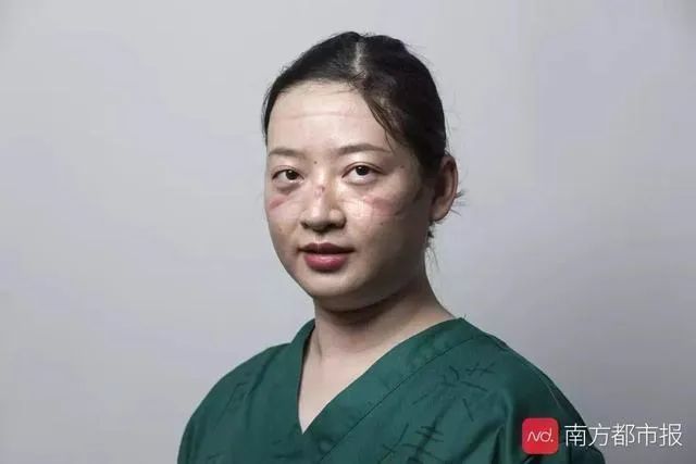 痛哭、失眠、崩潰：疫情過后，他們是最痛苦的人