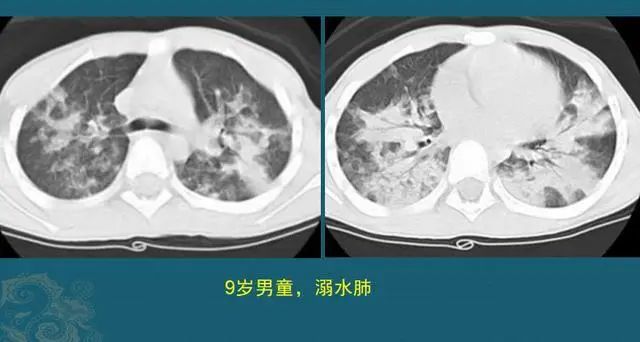 重慶8名小學(xué)生溺亡：別等到來不及，才知道生命可貴