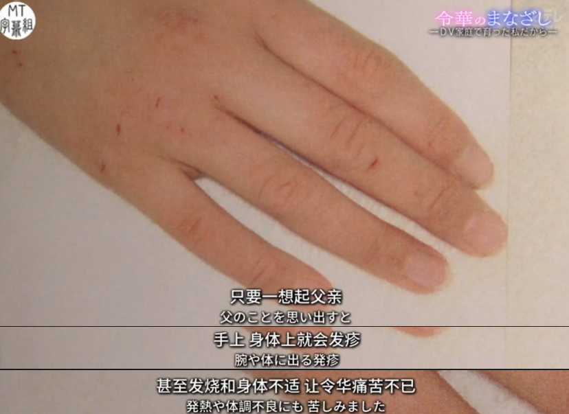 家暴幸存者的隱秘故事：我30歲了，還在為4歲時(shí)的噩夢(mèng)失眠