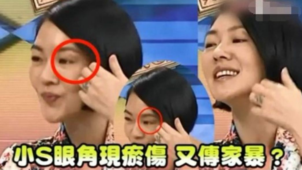 如何遠離家暴渣男，保護自己？