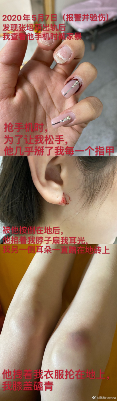 體育明星家暴美女妻子和岳母四姨