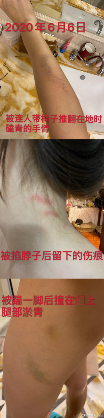 體育明星家暴美女妻子和岳母四姨