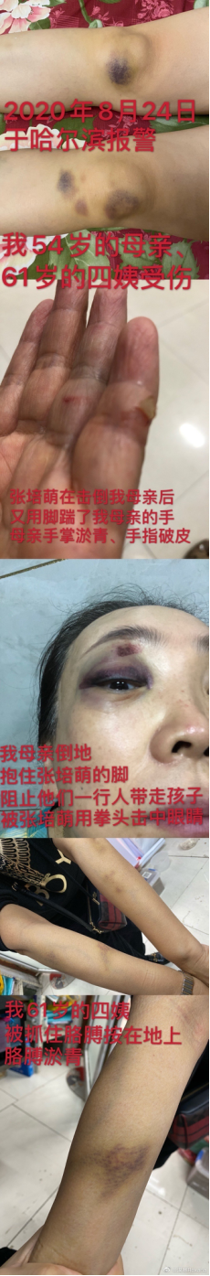 體育明星家暴美女妻子和岳母四姨