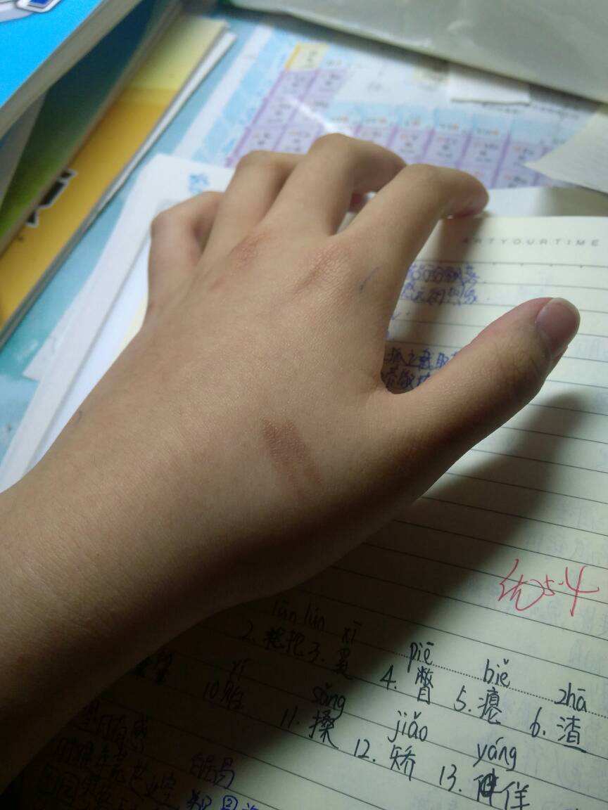 關(guān)注自傷自殘，為了活著，無(wú)聲吶喊