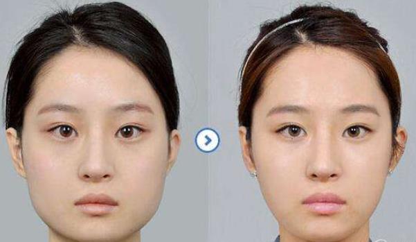 你對整容怎么看？做女人整好？