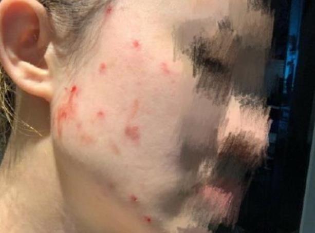 孩子被老師嚴(yán)重體罰致吐血真相