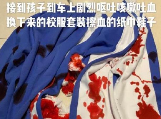 孩子被老師嚴(yán)重體罰致吐血真相