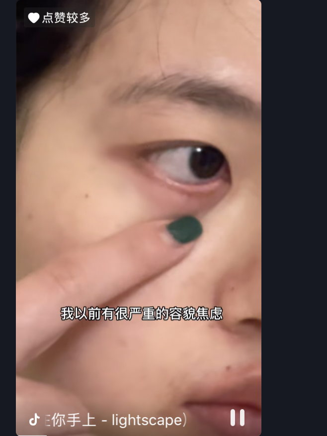 那些被外貌焦慮毀掉的90后