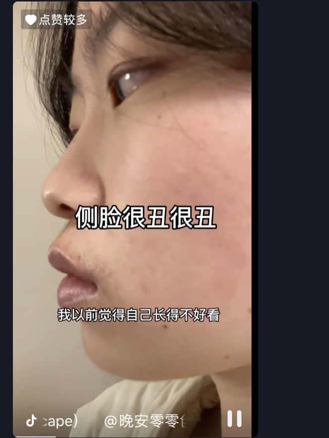 那些被外貌焦慮毀掉的90后