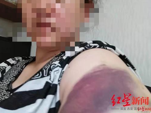 沉迷?xún)?yōu)化導(dǎo)致心理不健康，住進(jìn)精神病院