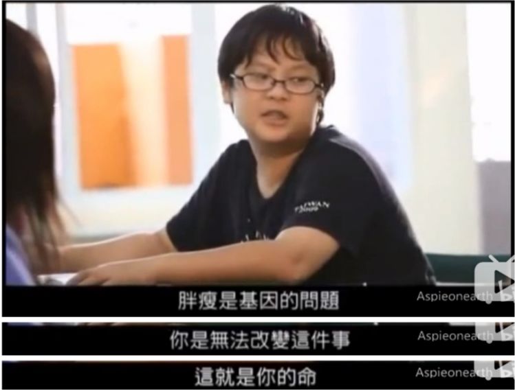 不合群的天才病、阿斯伯格癥