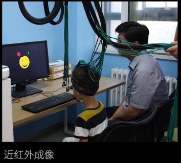 眼動(dòng)地形圖、早期鑒別孤獨(dú)癥孩子的重大發(fā)現(xiàn)