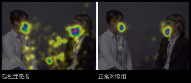 眼動(dòng)地形圖、早期鑒別孤獨(dú)癥孩子的重大發(fā)現(xiàn)