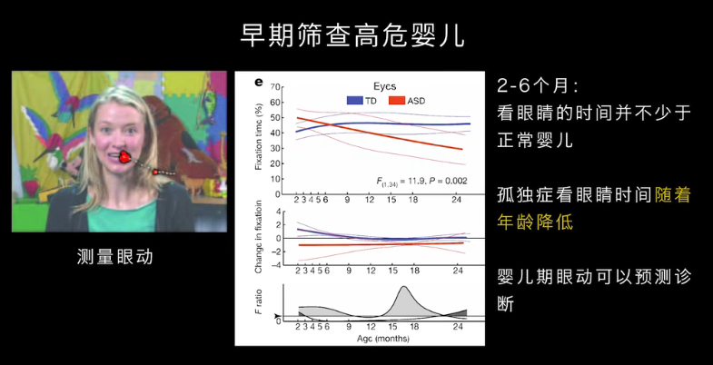 眼動(dòng)地形圖、早期鑒別孤獨(dú)癥孩子的重大發(fā)現(xiàn)