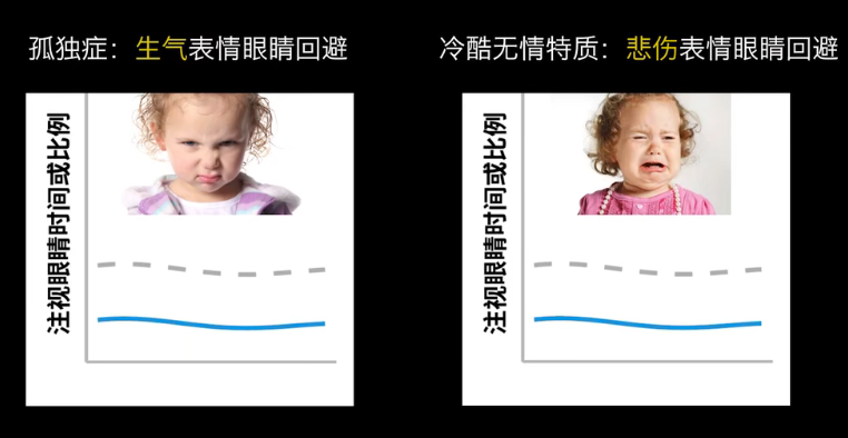 眼動(dòng)地形圖、早期鑒別孤獨(dú)癥孩子的重大發(fā)現(xiàn)