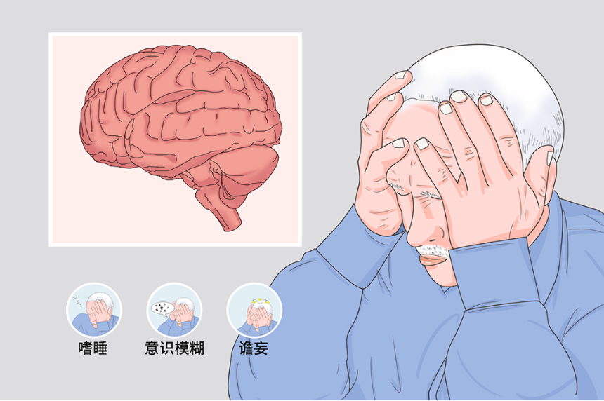 簡述意識(shí)障礙的分類及表現(xiàn) 意識(shí)障礙是什么