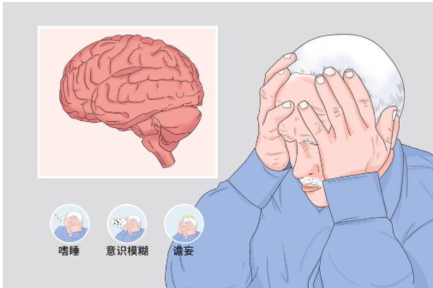 進行性意識障礙是什么意思
